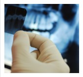root canal pain, toothache treatment Federal Way
