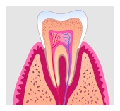root canal in Federal Way